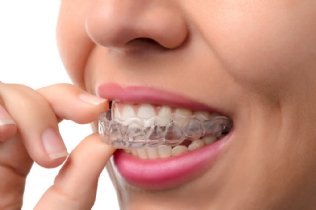 abgebrochener Zahn Behandlung
